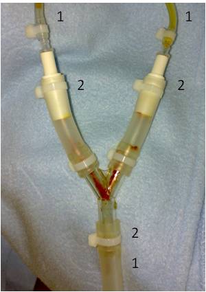 splitting chest drain